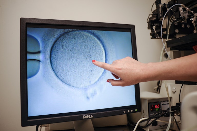 A hand points to an ovocyte on the computer screen.
