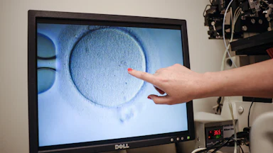 A hand points to an ovocyte on the computer screen.