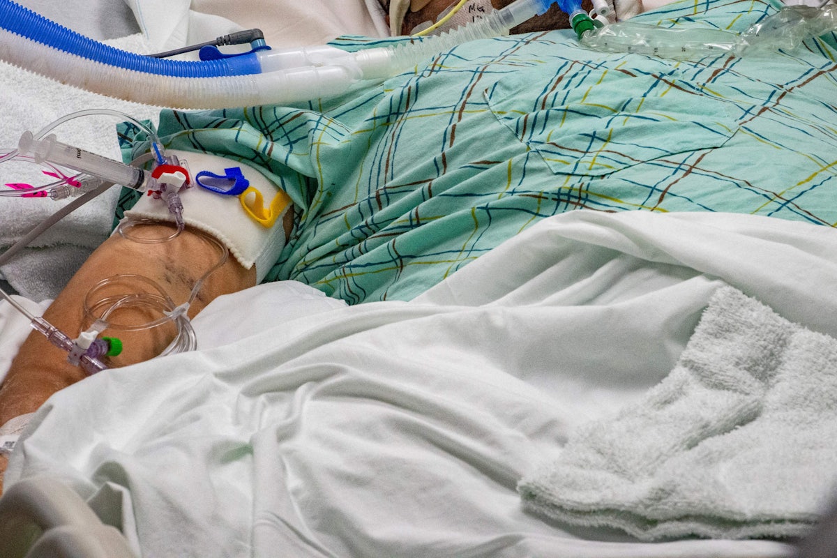 A patient's arm is seen with tubes attached.