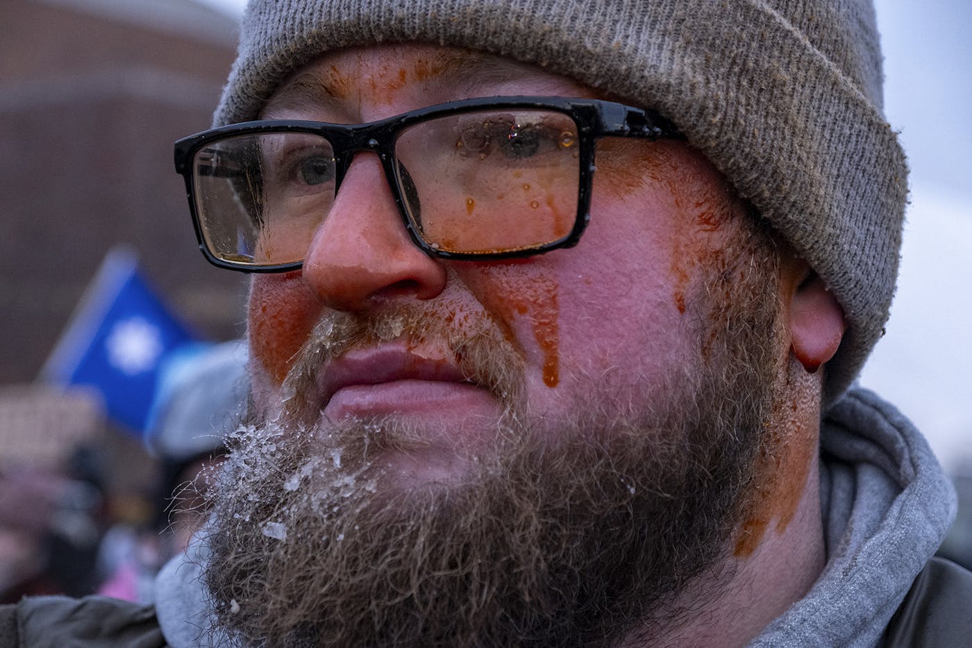 A protester after being pepper-sprayed by ICE agents