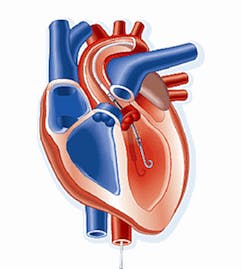 heart