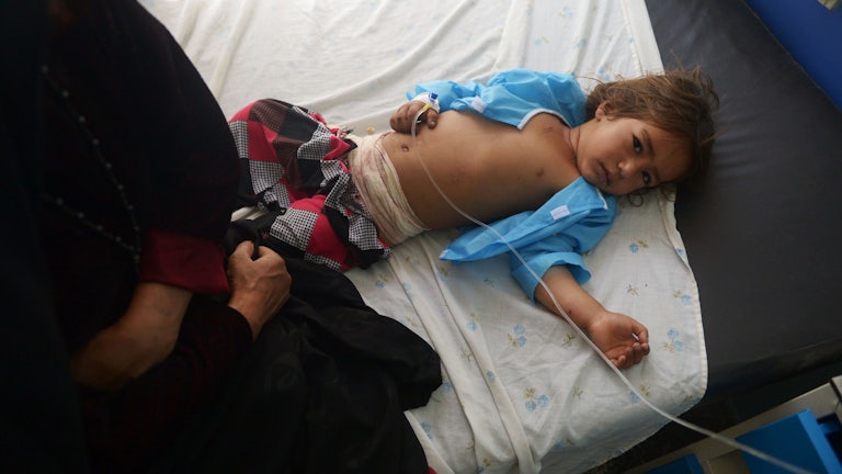An injured Afghan girl receives treatment at a hospital following an airstrike in Herat in August 2017.