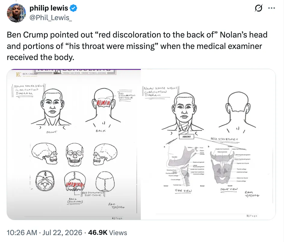 X screenshot philip lewis
@Phil_Lewis_
Ben Crump pointed out “red discoloration to the back of” Nolan’s head and portions of “his throat were missing” when the medical examiner received the body.
(screenshots of autopsy)