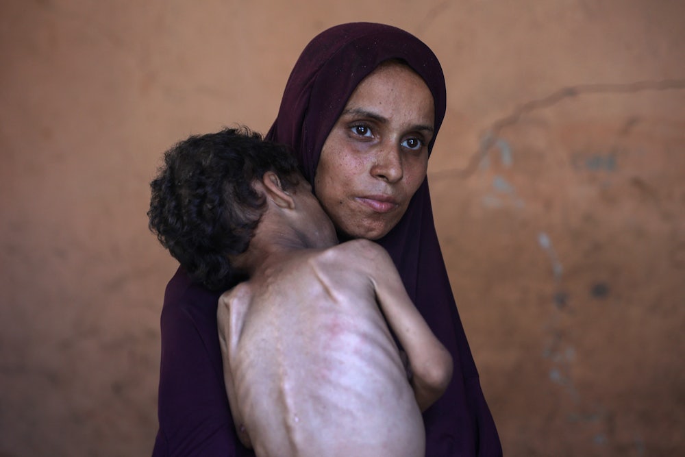 Naeema, a 30-year-old Palestinian mother, holds her malnourished 2-year-old son Yazan in the Al-Shati refugee camp