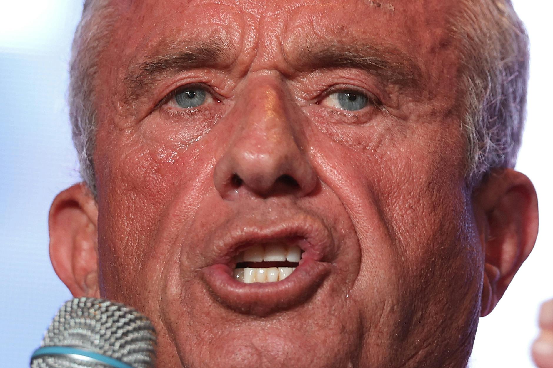 A closeup of Robert F. Kenedy Jr.'s face talking. 