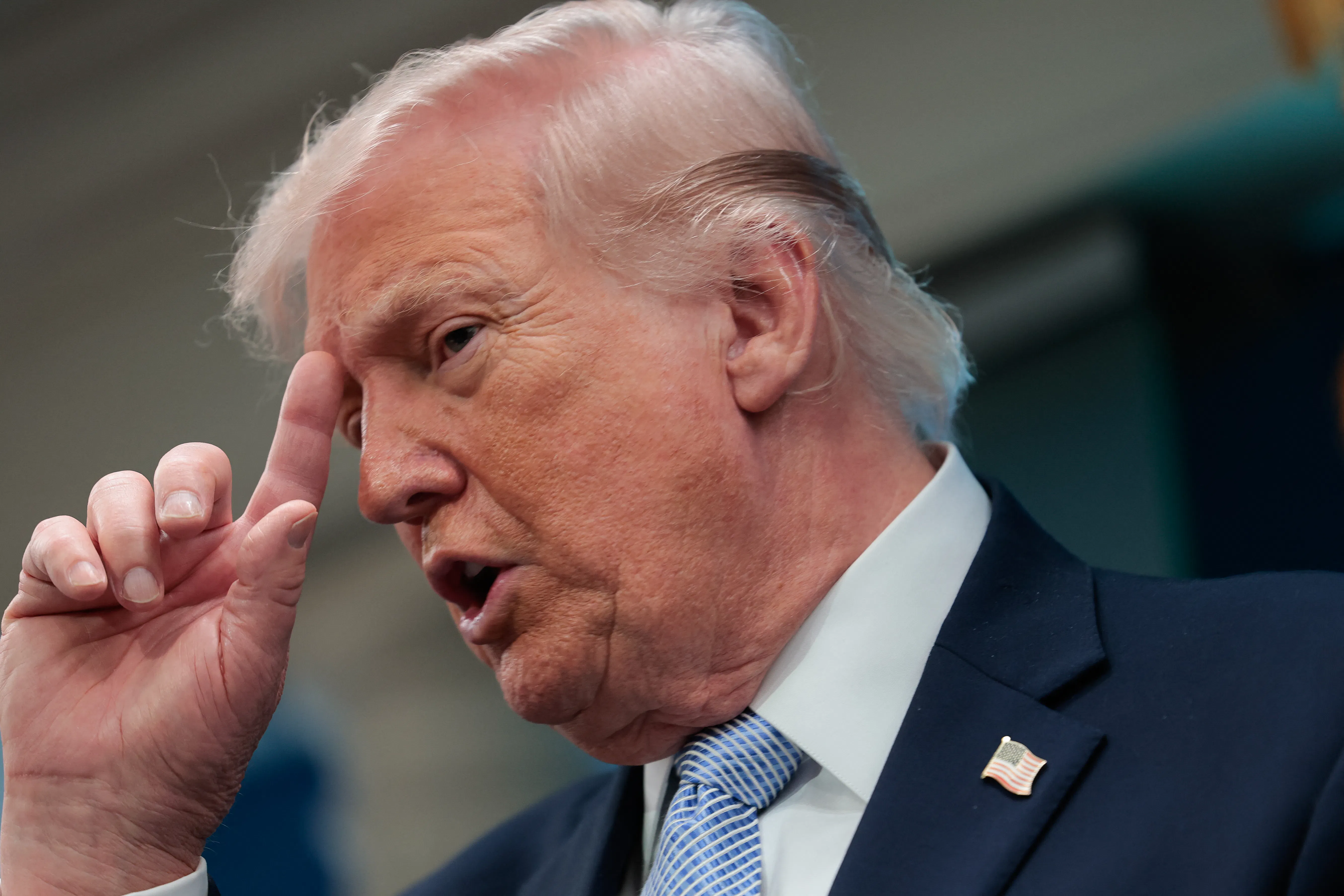President Trump places his index finger on his forehead