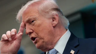 President Trump places his index finger on his forehead