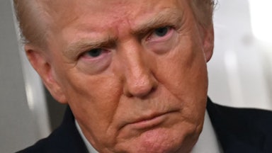 Donald Trump glowers