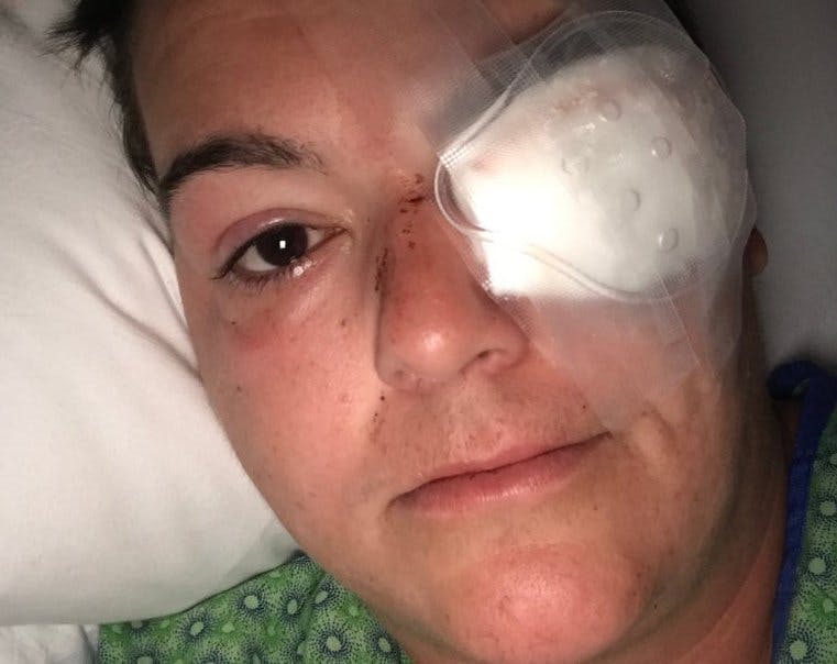 I want my left eye back': those injured by 2020's police violence