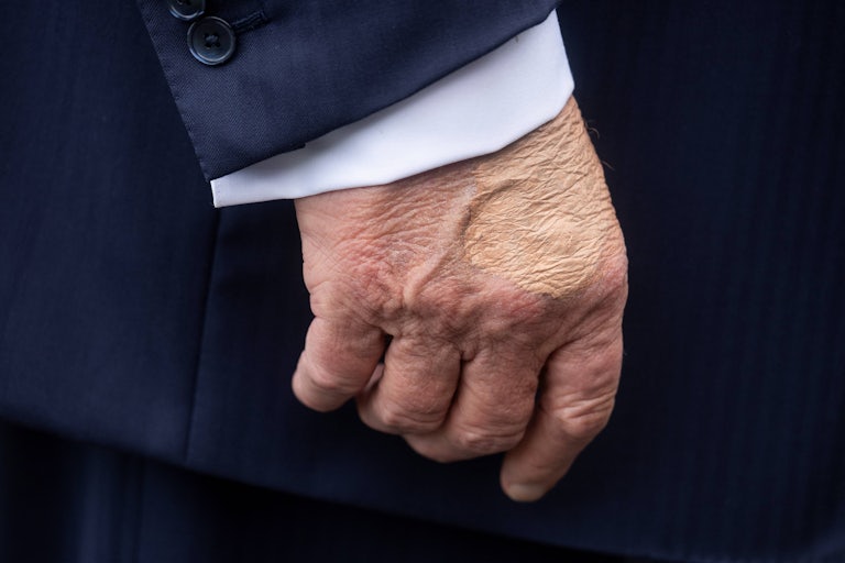 Donald Trump has makeup on his hand while walking outside the White House