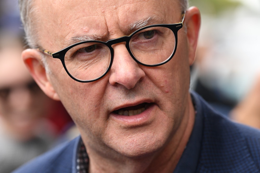 Anthony Albanese speaks.