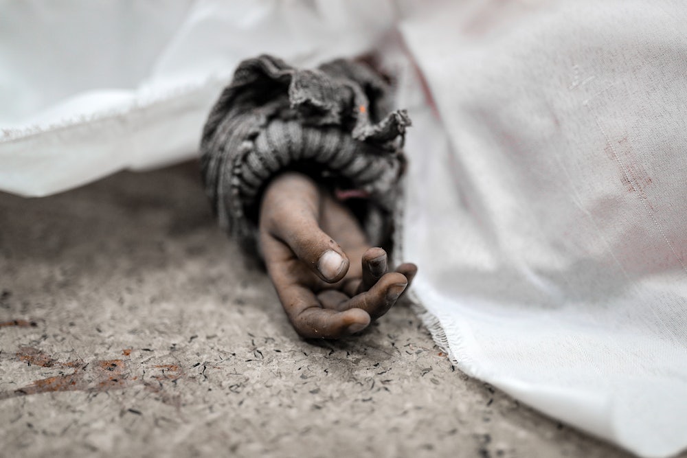 Palestinians alive and dead were brought to Nasser Hospital