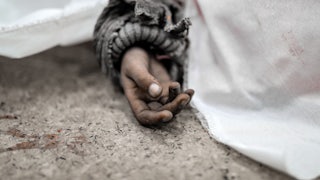 Palestinians alive and dead were brought to Nasser Hospital