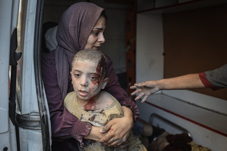 A woman holds a child covered in dust and with blood dripping from his forehead.