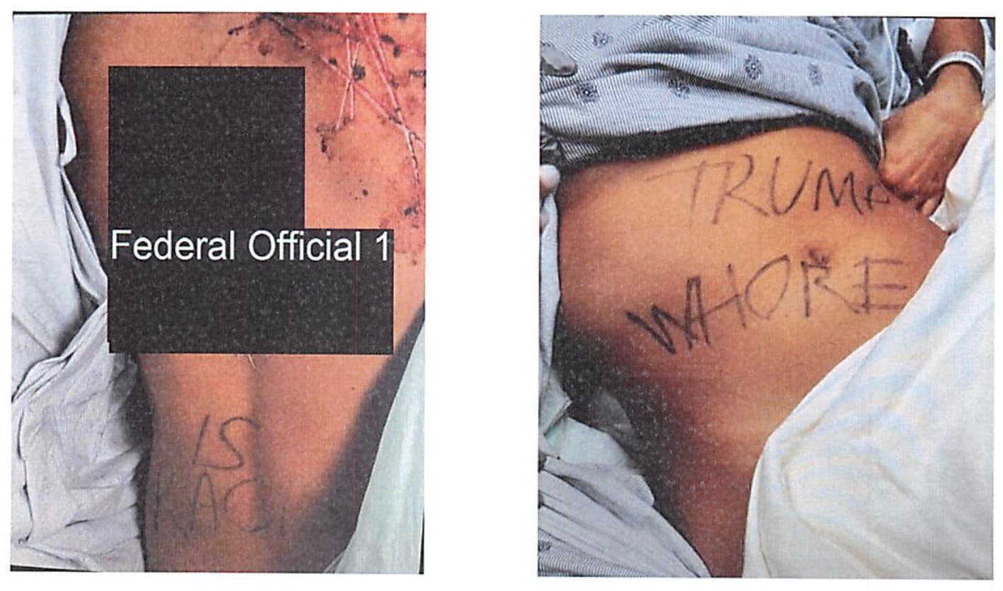 Photos of the aide's back and stomach. On her back is written "[REDACTED FEDERAL OFFICIAL 1] IS RACIST" and on her stomach is "TRUMP WHORE." 