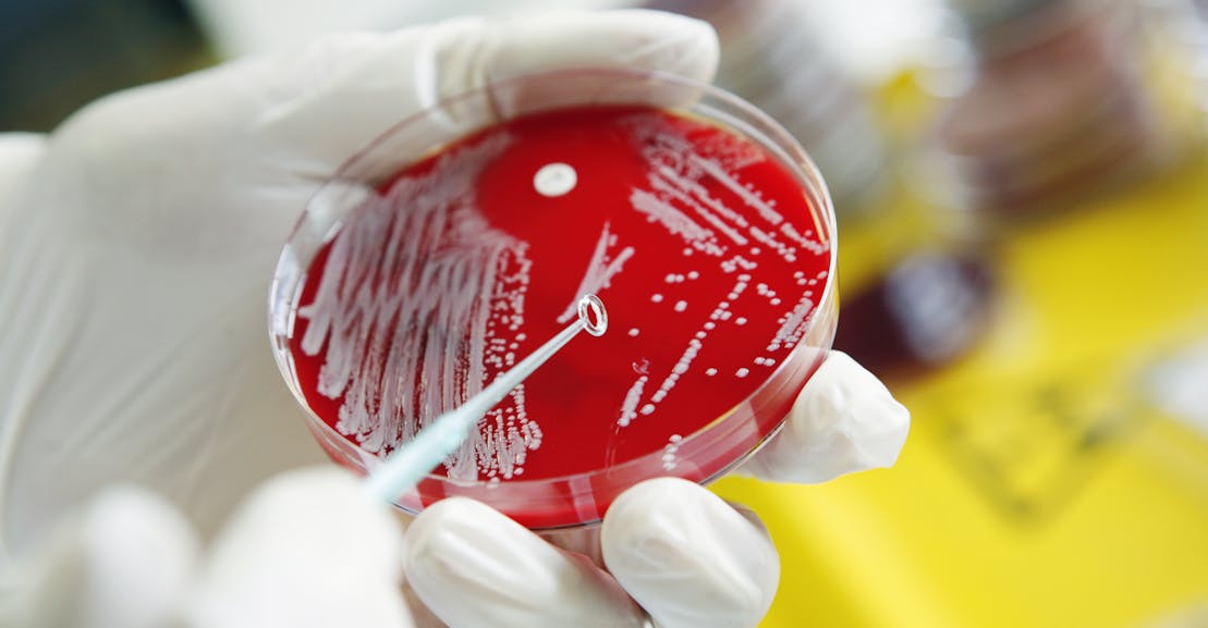 Are Germs the Main Characters in History? Are Germs the Main Characters in History?