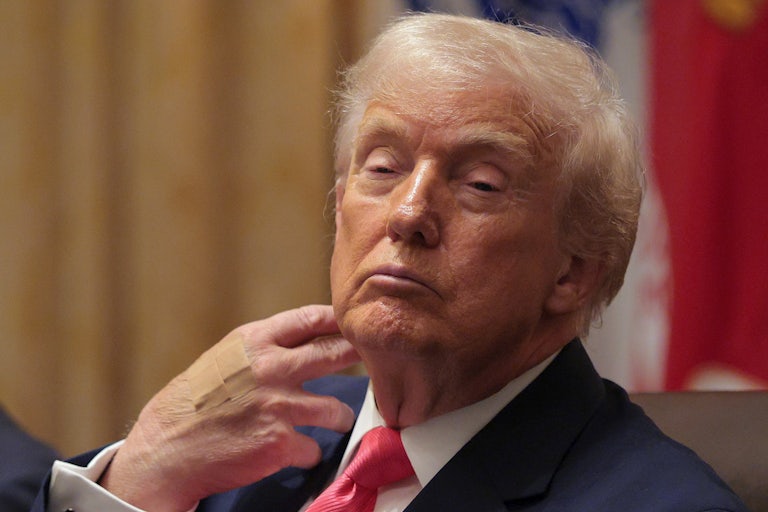 Donald Trump's eyes close as he scratches his neck. His hand has two bandaids on it, likely to cover the spot where there is a bruise.