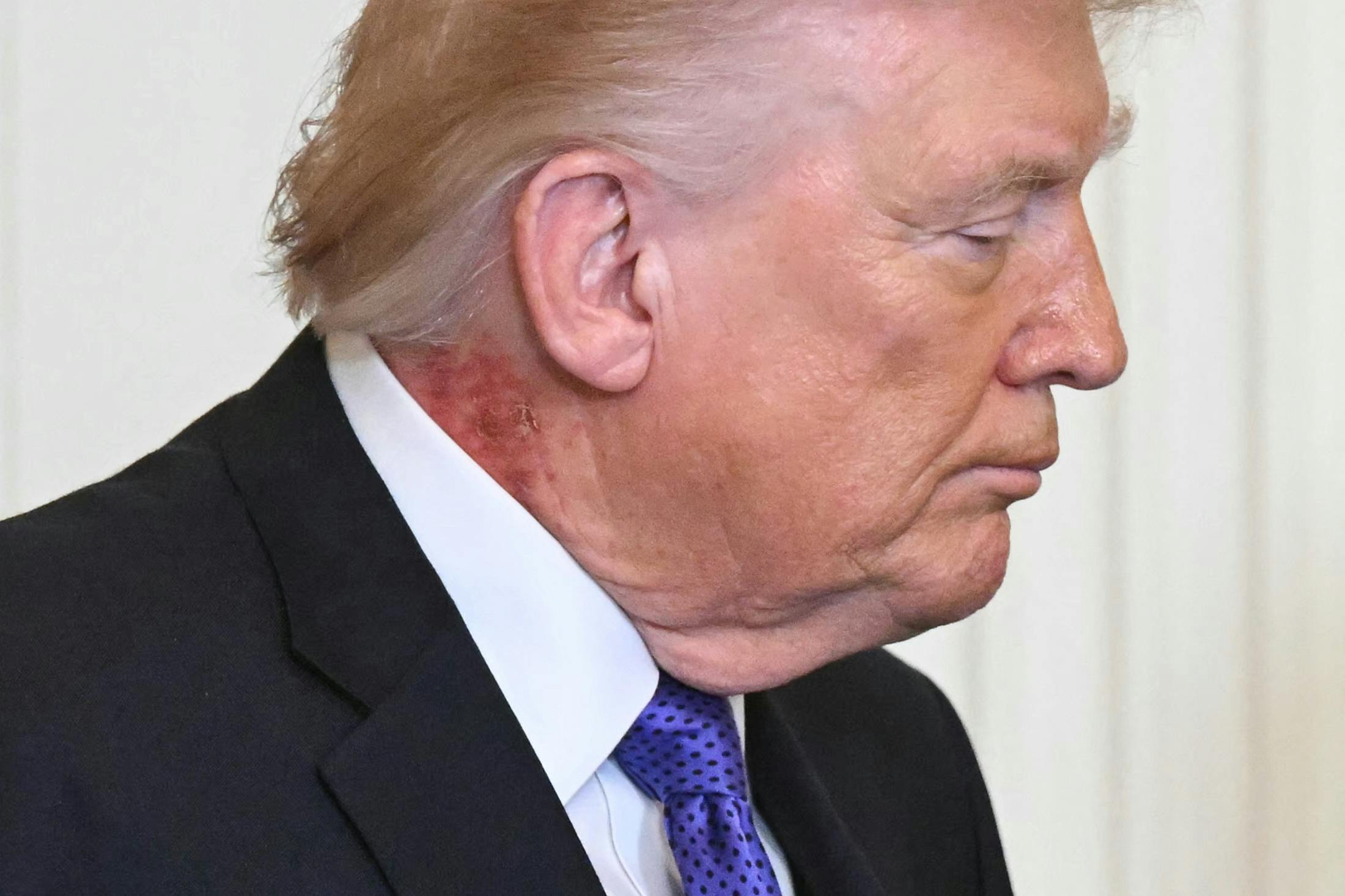 Donald Trump in profile looking downcast