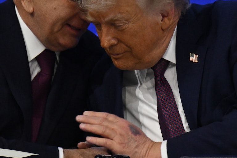 Donald Trump listens as Uzbek President Shavkat Mirziyoyev speaks in his ear. A large bruise is visible on the back of Trump's hand
