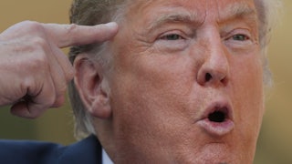 Donald Trump points at his own head
