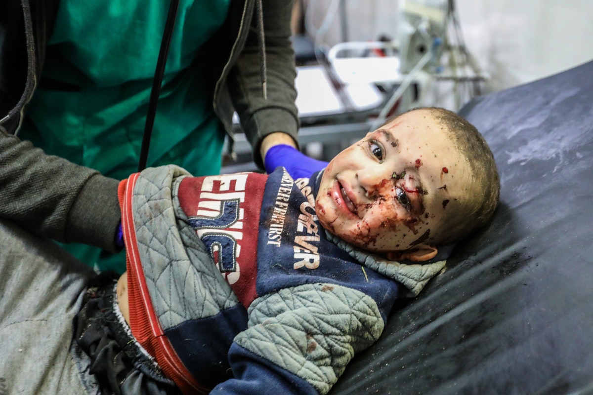 Is the Flood of Graphic Imagery From Gaza Warping Our Perception of War? Is the Flood of Graphic Imagery From Gaza Warping Our Perception of War?