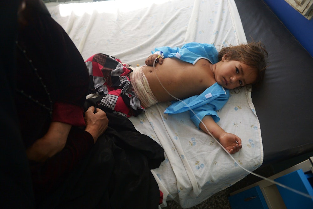An injured Afghan girl receives treatment at a hospital following an airstrike in Herat in August 2017.