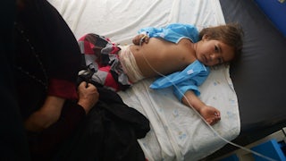 An injured Afghan girl receives treatment at a hospital following an airstrike in Herat in August 2017.