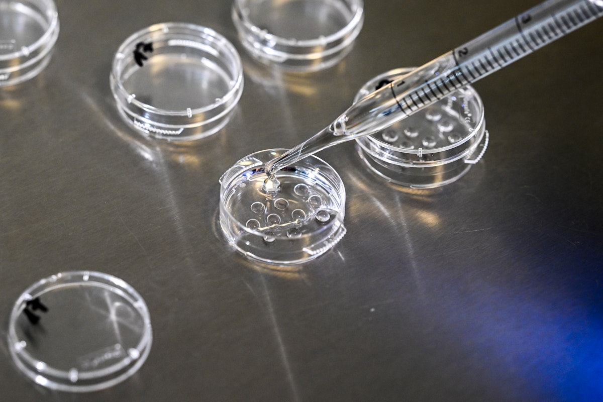 Horrific Alabama Embryo Ruling Is Still Having Tragic Effects on IVF Horrific Alabama Embryo Ruling Is Still Having Tragic Effects on IVF