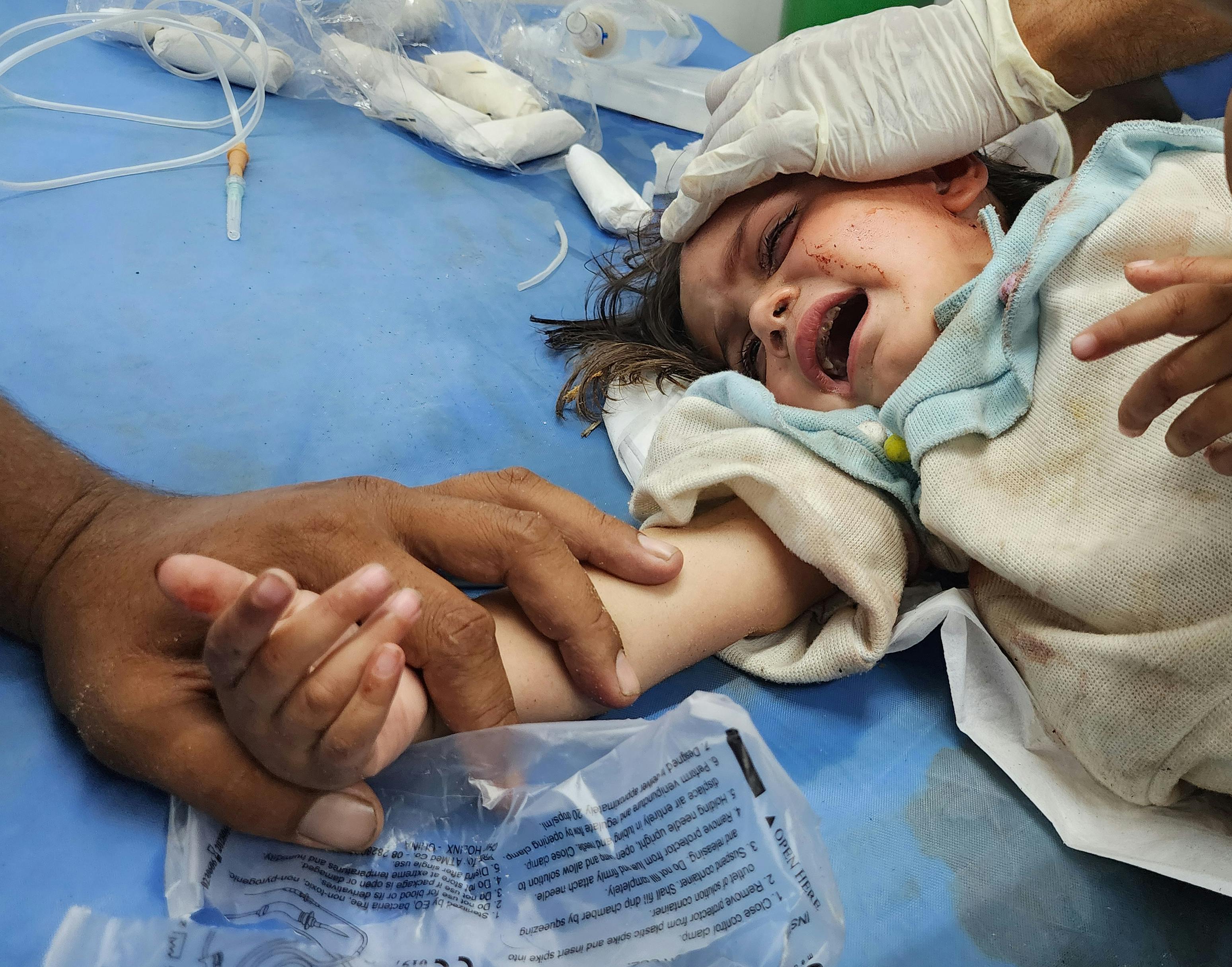 A child injured in Israeli airstrikes on tents of displaced Palestinians in Rafah
