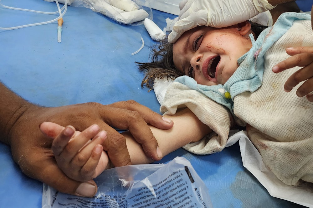 A child injured in Israeli airstrikes on tents of displaced Palestinians in Rafah